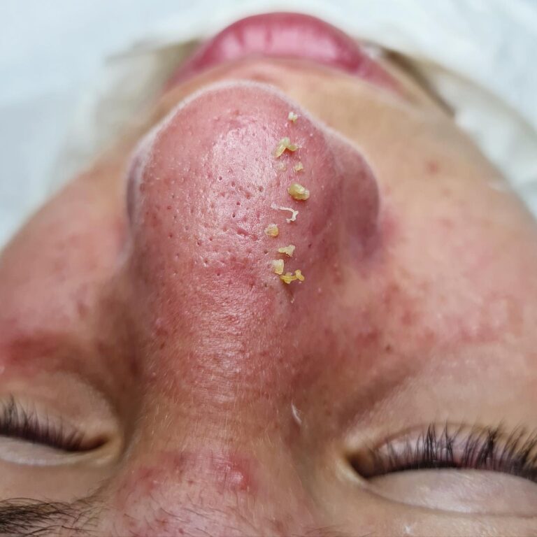 Estética facial · Estela Maris — centro estético e salão de beleza em Centro, Cerquilho - SP