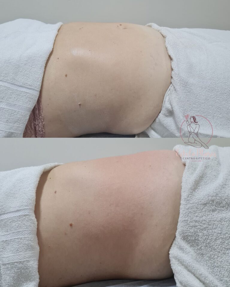 Estética corporal · Estela Maris — centro estético e salão de beleza em Centro, Cerquilho - SP