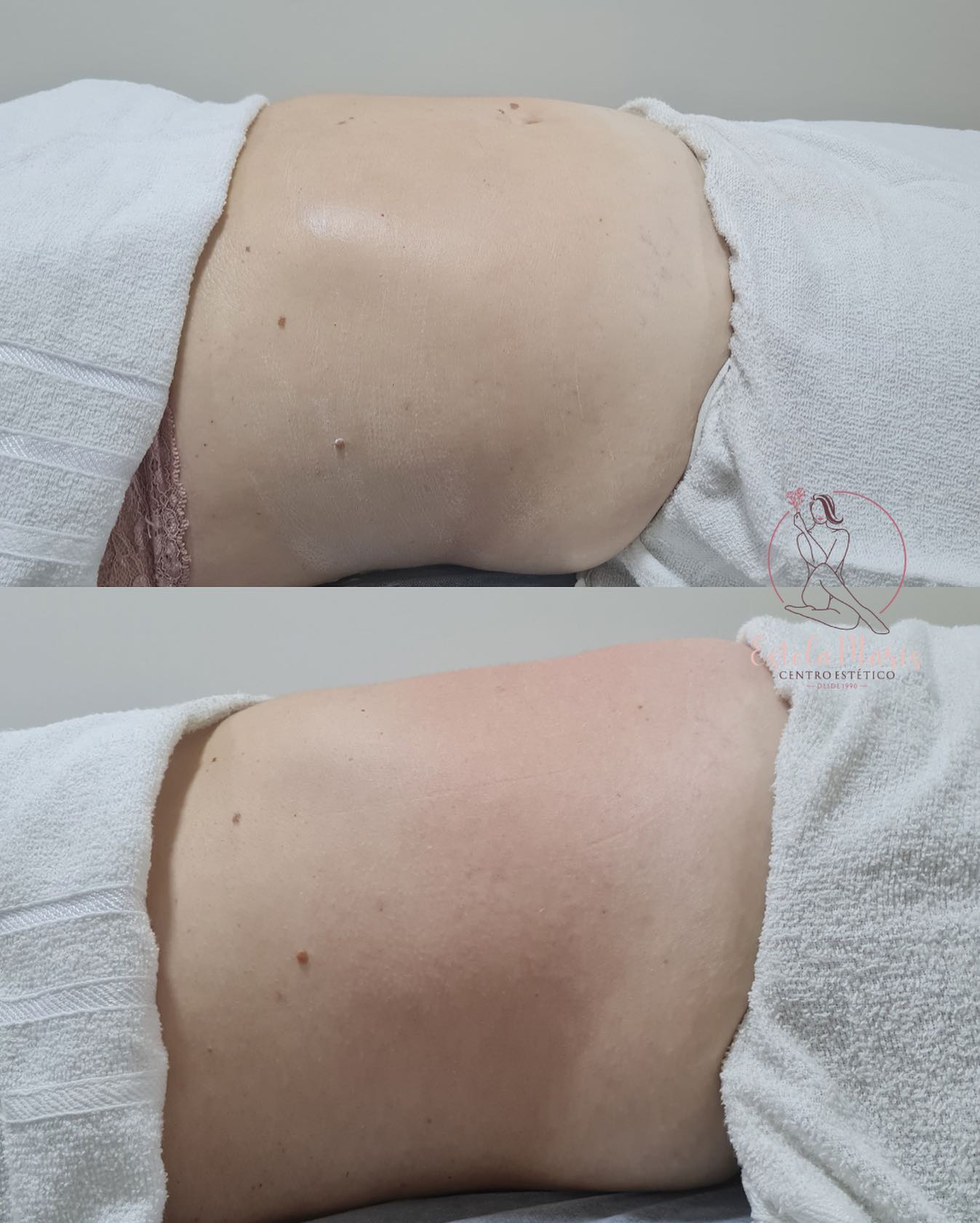Estética Corporal em Cerquilho - Estela Maris Estética e Salão Estética Corporal em Cerquilho - Estela Maris Estética e Salão